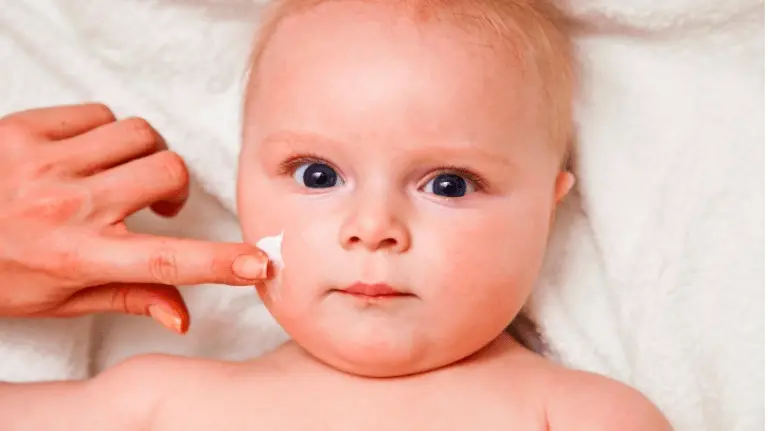Eczema bayi ubat untuk Krim Tak