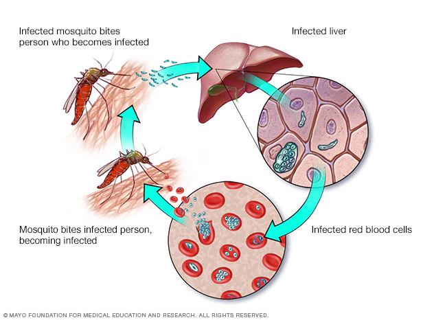 penyakit malaria