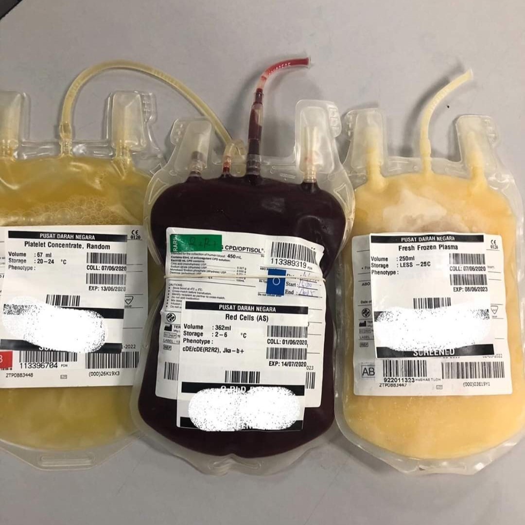 Kebaikan 3 Komponen Darah Hasil Daripada Satu Beg Derma 