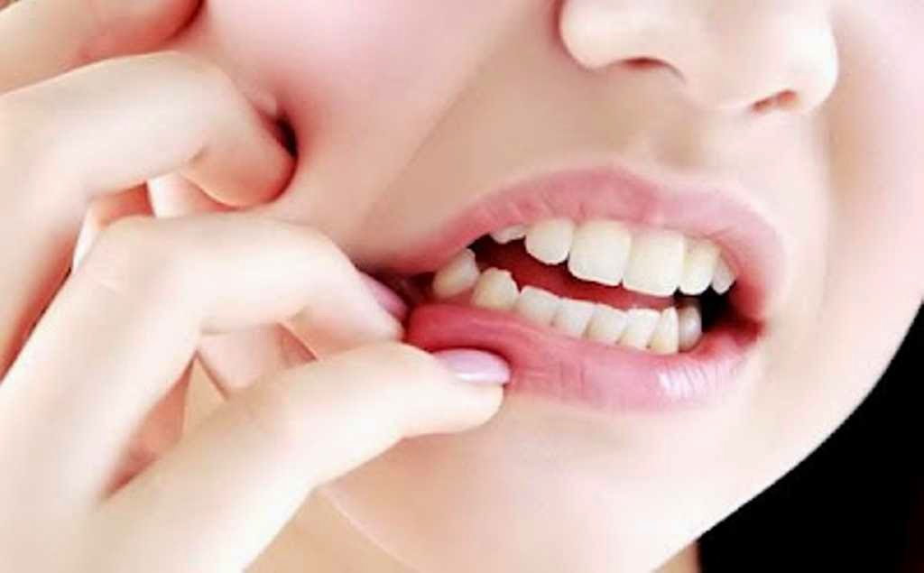 20 Petua Hilangkan Sakit Gigi Ketika Mengandung Tanpa Ubat 