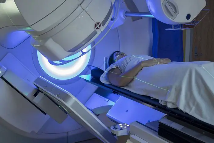 RADIOTION THERAPY